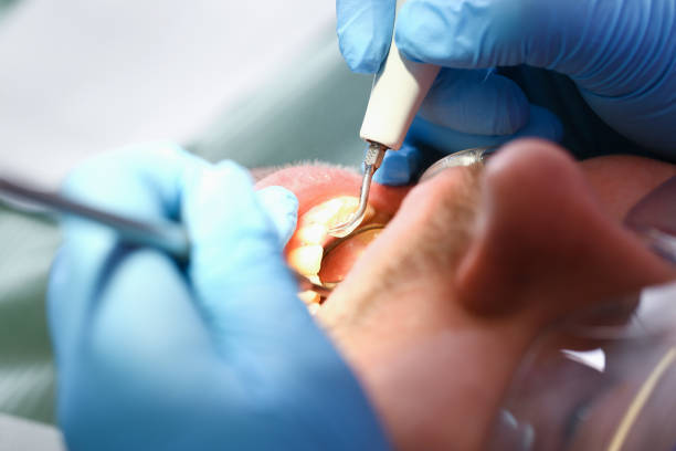 Best Emergency Treatment for Oral Infections in Marion Oaks, FL