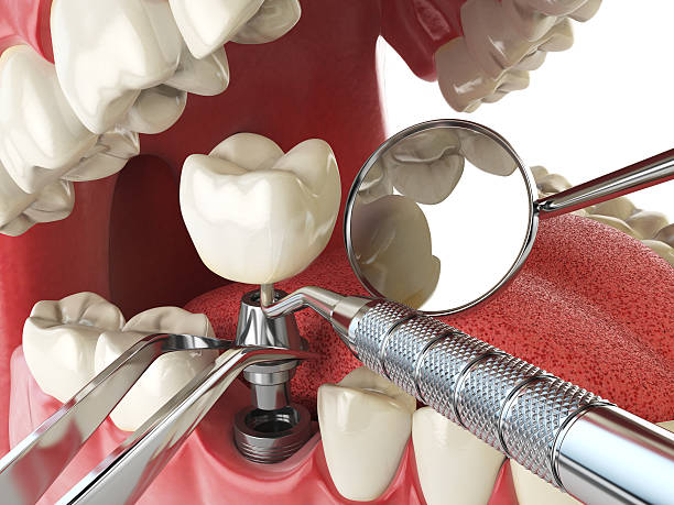 Best Emergency Denture Repair in Marion Oaks, FL